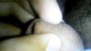 Grânulos de fordyce penis