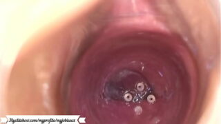Espinhas na vagina