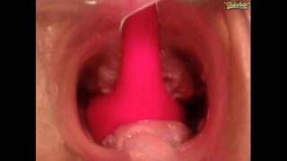Vício dentro da vagina
