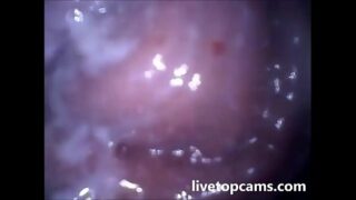 Câmera dentro da vagina mostra engravidado