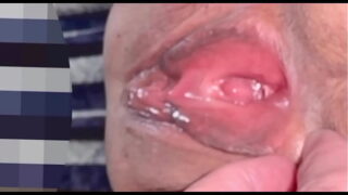 Od.a.lis erome